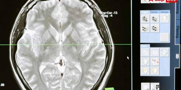 दिमाग के कीड़ों से बच्चों को कैसे पड़ते हैं दौरे? डॉक्टर से समझें खतरा और बचने के तरीके