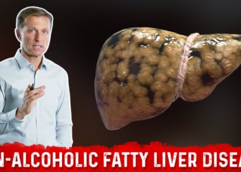 The REAL Causes of Fatty Liver Disease (NAFLD) – Dr.Berg
