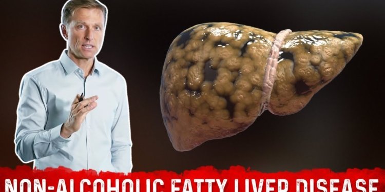 The REAL Causes of Fatty Liver Disease (NAFLD) – Dr.Berg
