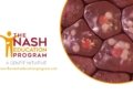 NASH liver disease progression in 3D: from healthy liver to cirrhosis