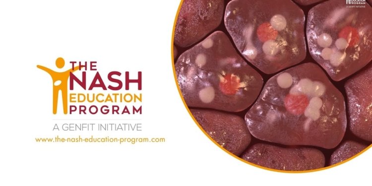 NASH liver disease progression in 3D: from healthy liver to cirrhosis