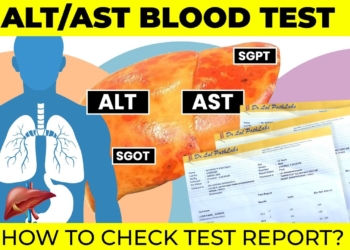 ALT AST Blood Test | liver function test | #hepatitis