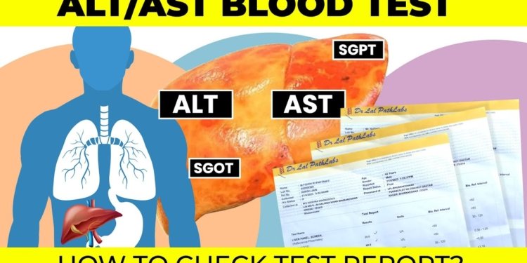 ALT AST Blood Test | liver function test | #hepatitis