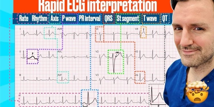 Rapid, structured ECG interpretation: A visual guide FOR REVISION!! #electrocardiogram