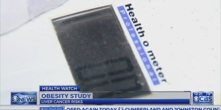 Dr. Campbell: Obesity and diabetes tied to liver cancer