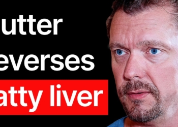 Fix Fatty Liver Naturally (10 COMMON Symptoms)