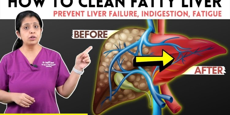 How to Cure Fatty Liver | கல்லீரலில் கொழுப்பை சுத்தம் செய்வது எப்படி | Dr. Deepthi Jammi