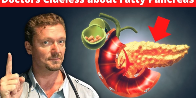 Doctors Clueless about Fatty Pancreas [Worse than Fatty Liver] 2024