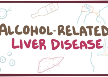 Alcohol-related liver disease - causes, symptoms & pathology