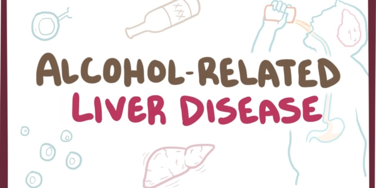 Alcohol-related liver disease - causes, symptoms & pathology