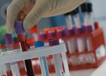 A gloved hand reaches for vials of blood.