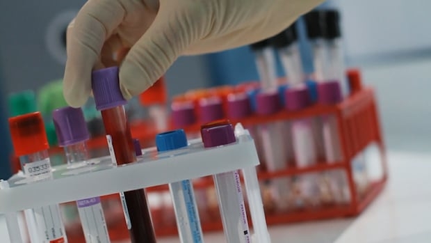 A gloved hand reaches for vials of blood.