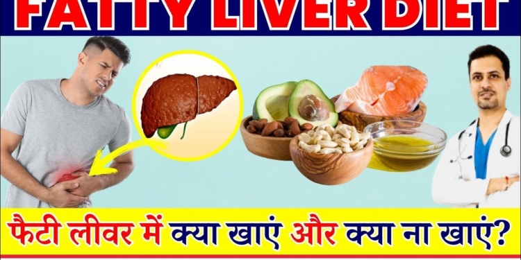 FATTY LIVER DIET | फैटी लिवर क्या है और फैटी लिवर में क्या खाना चाहिए? | Fatty Liver Treatment