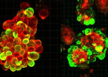 A secret cell alliance may explain why ovarian cancer is so deadly