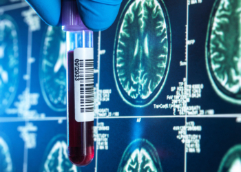 Alzheimer's 'Clock' Uses Blood Test to Forecast Symptom Onset