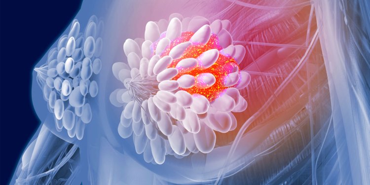 Does Abortion or Miscarriage Contribute to Breast Cancer Risk?