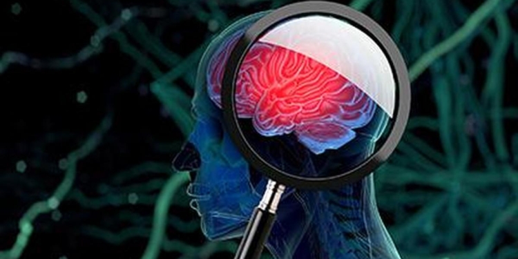 NIMHANS study demonstrates promise in intranasal therapy for Parkinson’s disease