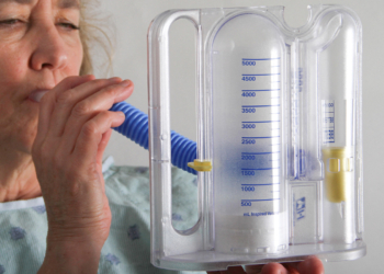 Rheumatoid Arthritis: How Best to Gauge ILD Risk in Light of Comorbidities?