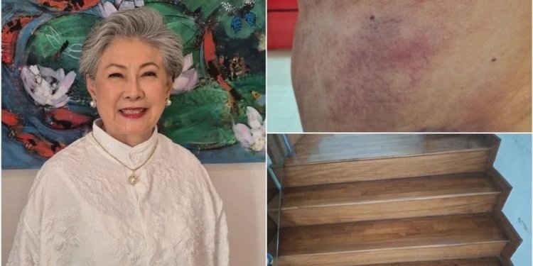 Singaporean actress Jin Yinji, 78, recovering after fall at home