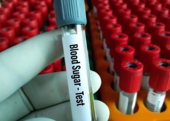 Standard diabetes test glycated haemoglobin (HbA1c) may mislead in diagnosis of type-2 diabetes in India’s population: experts