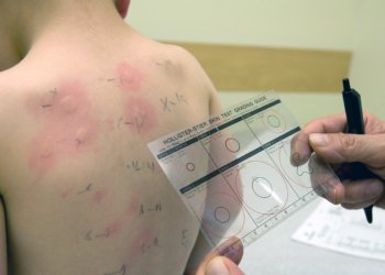 U.S., Australia Lead the World on Kids' Food Allergy Rates