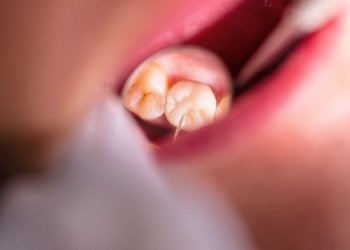 Why a toothache hurts more at night 