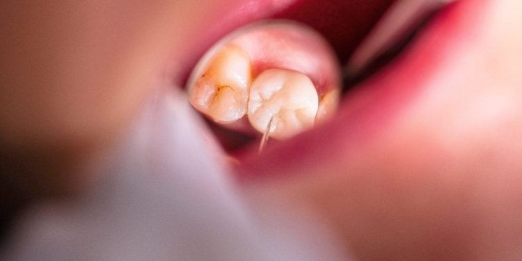 Why a toothache hurts more at night 