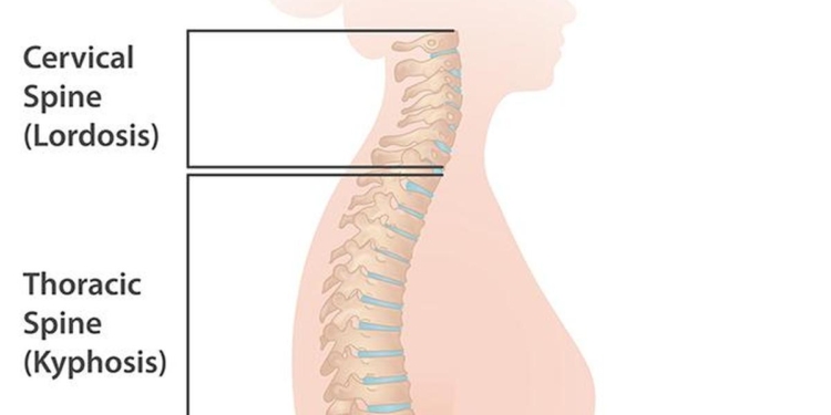 Why delaying spine surgery can lead to permanent disability
