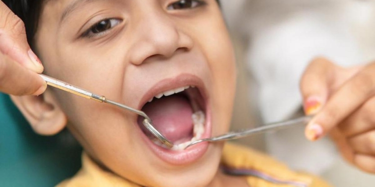 Why the begin-early mantra is a significant prevention strategy in dentistry