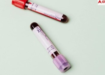 लगातार थकान और बार-बार बुखार आना सामान्य नहीं, हो सकते हैं इस कैंसर के लक्षण