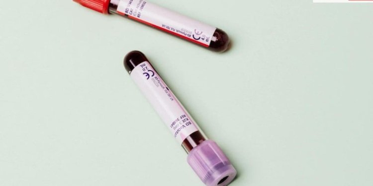 लगातार थकान और बार-बार बुखार आना सामान्य नहीं, हो सकते हैं इस कैंसर के लक्षण