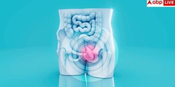 Colon Cancer Symptoms: पेट दर्द और थकान को न करें नजरअंदाज, युवाओं को अपना शिकार बना रहा है ये खतरनाक कैंस