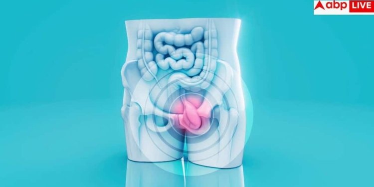 Colon Cancer Symptoms: पेट दर्द और थकान को न करें नजरअंदाज, युवाओं को अपना शिकार बना रहा है ये खतरनाक कैंस