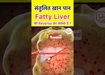Can fatty liver be reversed ?  #shorts  #fattyliver  #fattyliverdisease
