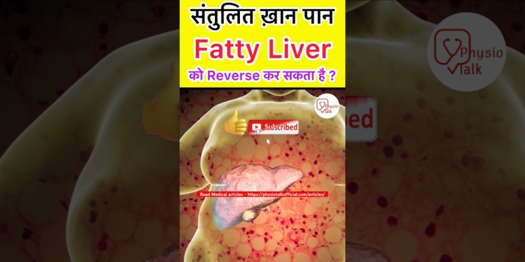 Can fatty liver be reversed ?  #shorts  #fattyliver  #fattyliverdisease