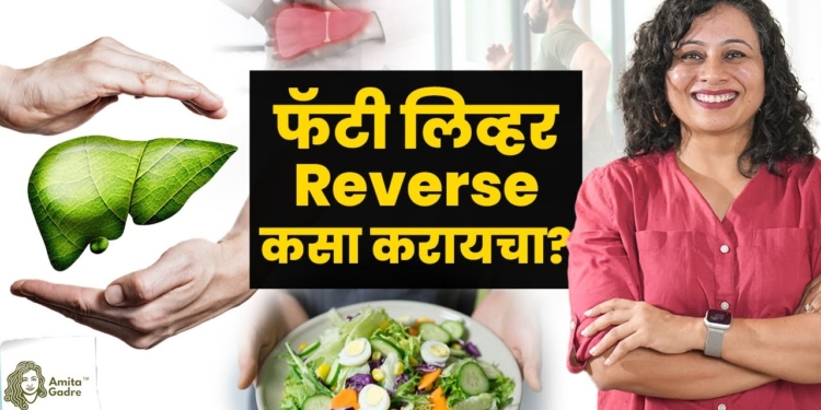 फॅटी लिव्हर reverse कसा करायचा? | How to Reverse Fatty Liver? | Amita Gadre | Marathi Podcast