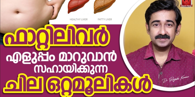 ഫാറ്റിലിവർ എളുപ്പം മാറുവാൻ ചില നാച്ചുറൽ ഒറ്റമൂലികൾ. ഫാറ്റിലിവർ ഉള്ളവർ ഉപേക്ഷിക്കേണ്ട 5 കാര്യങ്ങൾ
