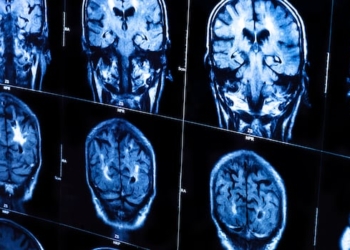 A group of CAT scans show the human brain.