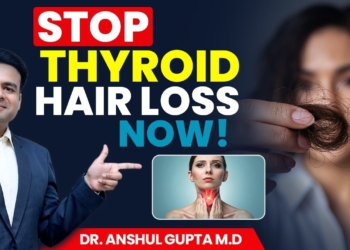 Stop Thyroid Hair Loss in Just 1 Day (Full Routine Revealed)