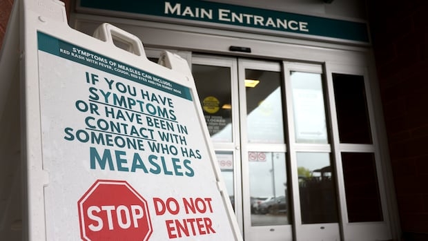 A white sign in front of a hospital entrance tells people not to enter if they have symptoms or have been in contact with someone who has measles.