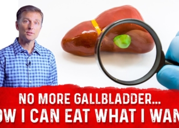 Gallbladder Removed: Can I Eat What I Want? – Dr. Berg