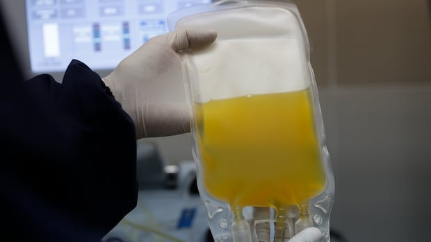 Gloved hands hold up a bag filled with yellow liquid.