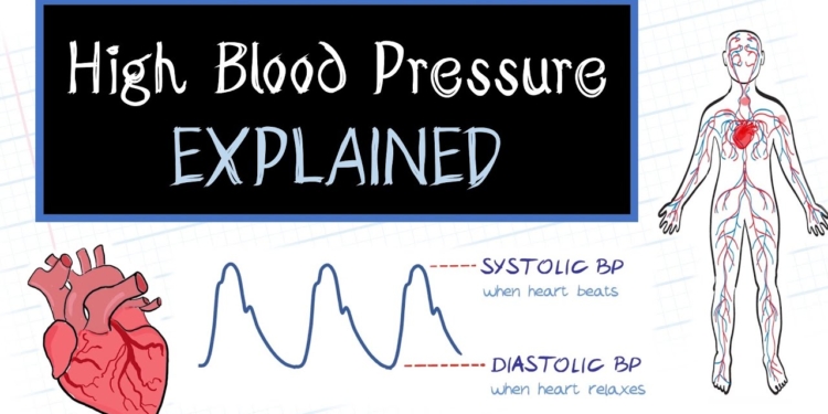 What is High Blood Pressure? (HealthSketch)