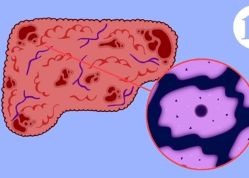 Scar wars: Repairing the liver