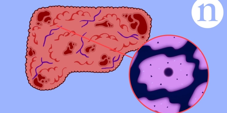 Scar wars: Repairing the liver