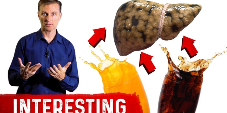 Soft Drinks and Fatty Liver Disease: Interesting