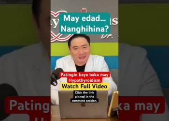 Hypothyroidism: Signs & Symptoms