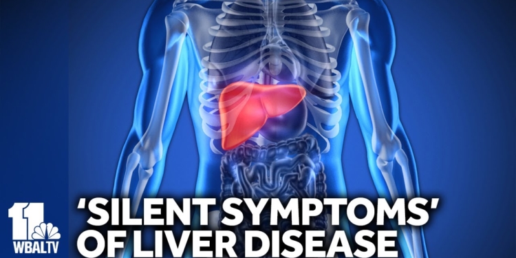 Liver disease can manifests with 'silent symptoms'