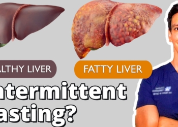 Intermittent Fasting for Fatty Liver | New clinical trial