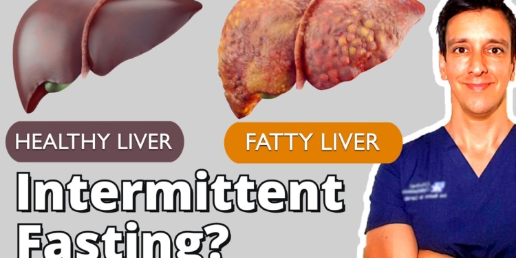Intermittent Fasting for Fatty Liver | New clinical trial